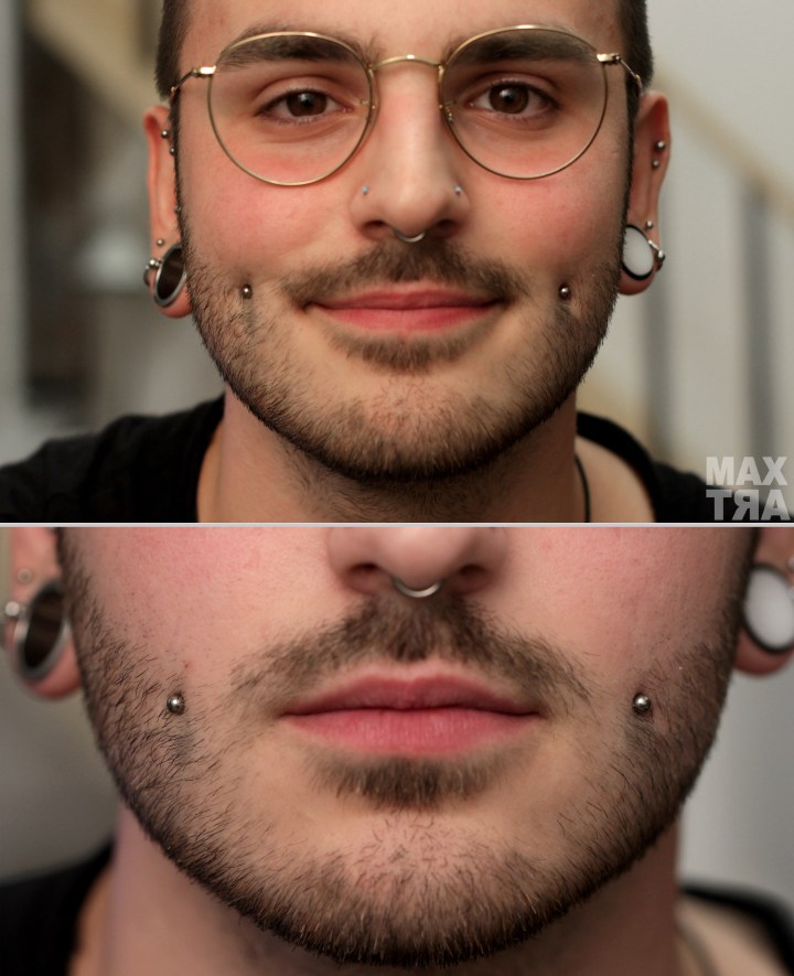 1 mese dp cambio 16mm