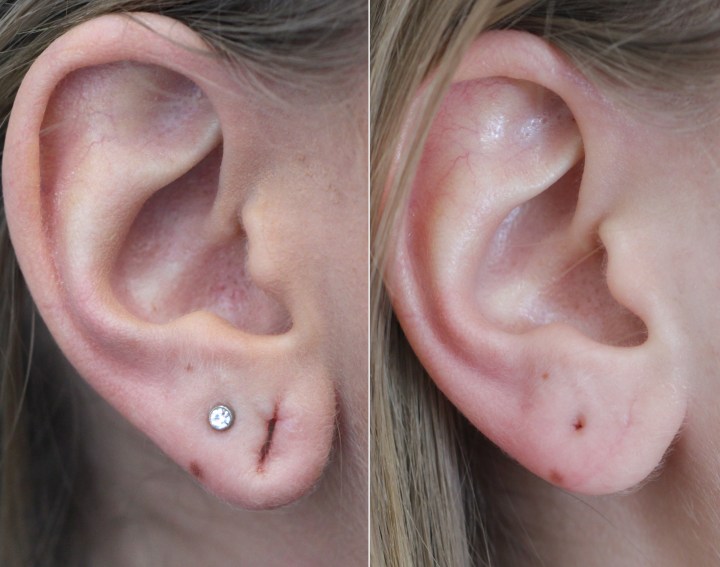 tipa garbatella dopo 3 mesi