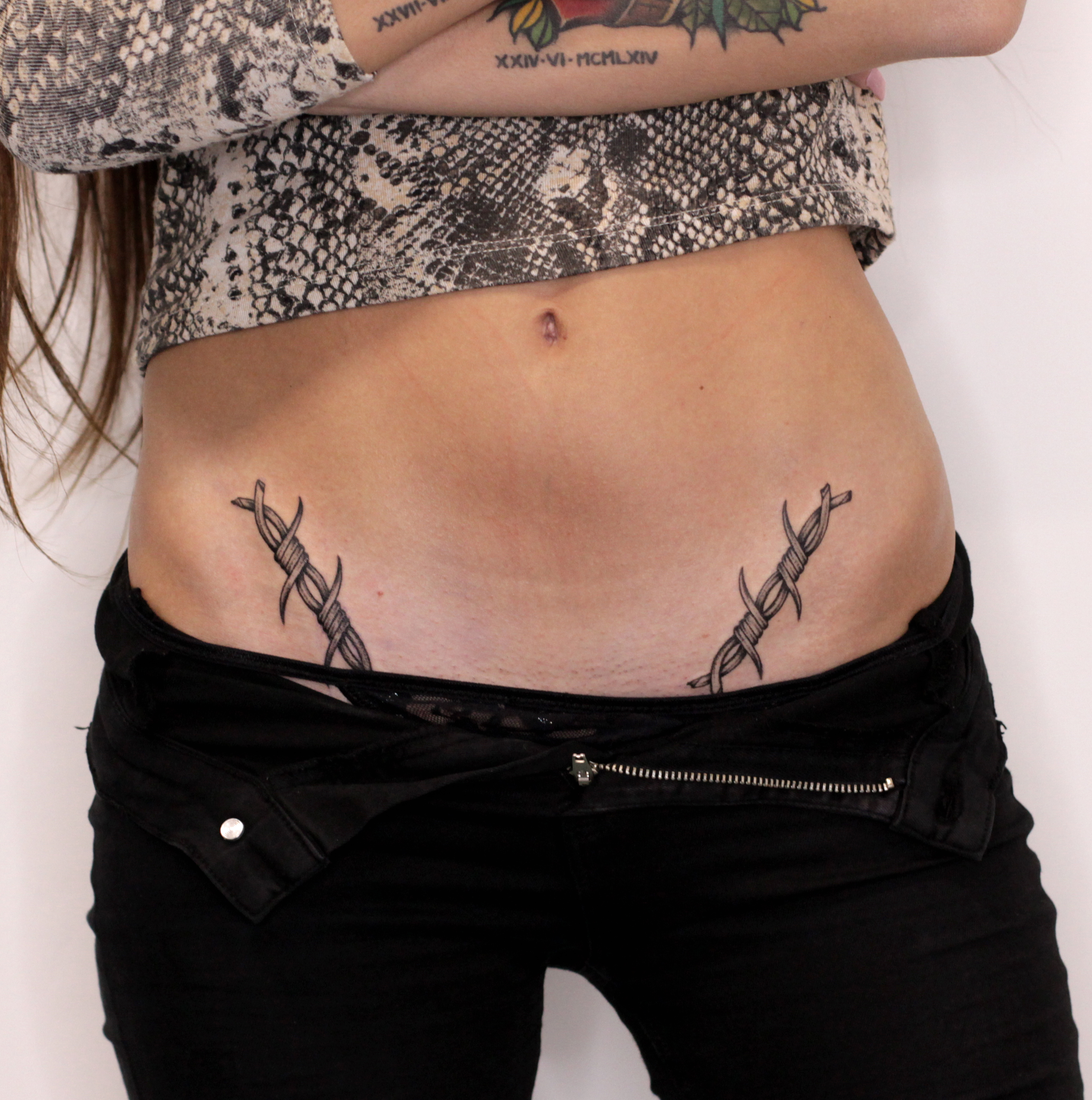 filo spinato inguine 1