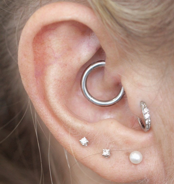 daith 2mm febbraio 20 (2)